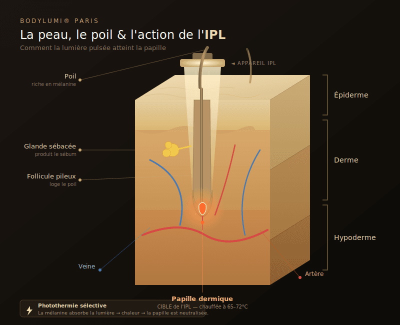  Infographie des 3 phases du cycle pilaire avec indication de la fenêtre d'action de l'IPL